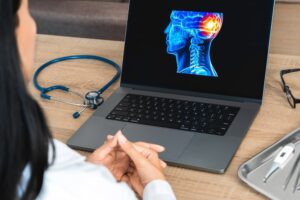 Doctor showing a x-ray of pain in the brain on a laptop